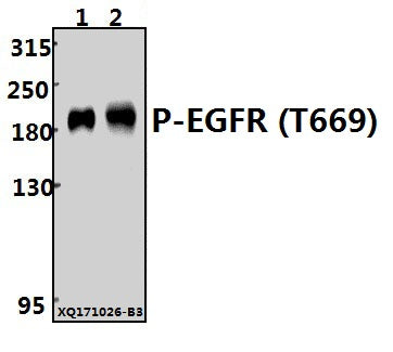 Western blot (WB) analysis of EGFR (phospho-T669) polyclonal antibody at 1:500 dilution
Lane1:HCC827 whole cell lysate(20ug)
Lane2:A549 whole cell lysate(40ug)