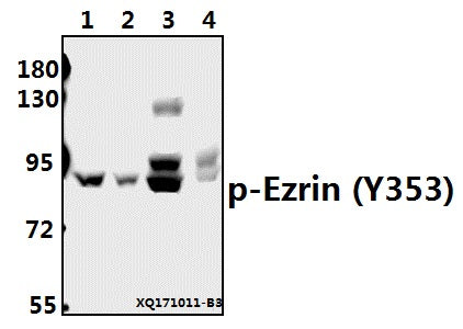 Western blot (WB) analysis of p-Ezrin (Y353) pAb at 1:500 dilution
Lane1:A549 whole cell lysate(40ug)
Lane2:HEK293T whole cell lysate(40ug)
Lane3:PMVEC whole cell lysate(40ug)
Lane4:3T3-L1 whole cell lysate(40ug)