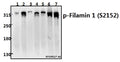 Western blot (WB) analysis of Filamin 1 (phospho-S2152) polyclonal antibody at 1:500 dilution
Lane1:Hela whole cell lysate(40ug)
Lane2:A549 whole cell lysate(20ug)
Lane3:The Lung tissue lysate of Rat(20ug)
Lane4:AML-12 whole cell lysate(40ug)
Lane5:CT26 whole cell lysate(40ug)
Lane6:SKOVCAR3 whole cell lysate(40ug)
Lane7:Panc1 whole cell lysate(40ug)