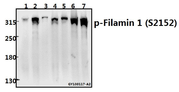 Western blot (WB) analysis of Filamin 1 (phospho-S2152) polyclonal antibody at 1:500 dilution
Lane1:Hela whole cell lysate(40ug)
Lane2:A549 whole cell lysate(20ug)
Lane3:The Lung tissue lysate of Rat(20ug)
Lane4:AML-12 whole cell lysate(40ug)
Lane5:CT26 whole cell lysate(40ug)
Lane6:SKOVCAR3 whole cell lysate(40ug)
Lane7:Panc1 whole cell lysate(40ug)