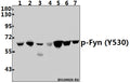 Western blot (WB) analysis of p-Fyn (Y530) pAb at 1:1000 dilution
Lane1:HepG2 whole cell lysate(40ug)
Lane2:A375 whole cell lysate(40ug)
Lane3:HEK293T whole cell lysate(40ug)
Lane4:PC12 whole cell lysate(40ug)
Lane5:AML-12 whole cell lysate(40ug)
Lane6:C6 whole cell lysate(40ug)
Lane7:CT-26 whole cell lysate(40ug)