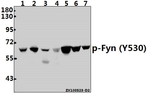 Western blot (WB) analysis of p-Fyn (Y530) pAb at 1:1000 dilution
Lane1:HepG2 whole cell lysate(40ug)
Lane2:A375 whole cell lysate(40ug)
Lane3:HEK293T whole cell lysate(40ug)
Lane4:PC12 whole cell lysate(40ug)
Lane5:AML-12 whole cell lysate(40ug)
Lane6:C6 whole cell lysate(40ug)
Lane7:CT-26 whole cell lysate(40ug)