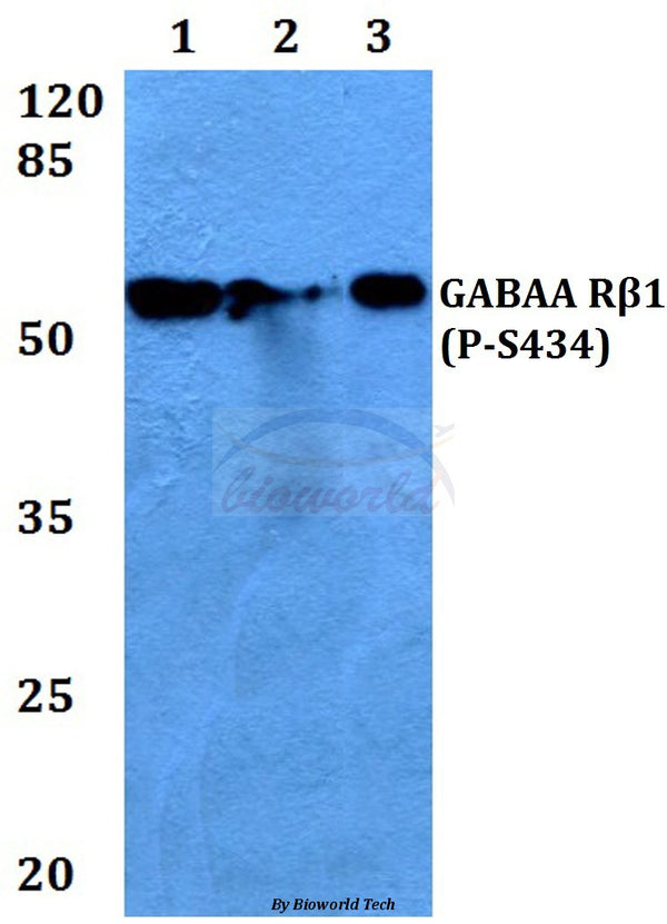 Western blot (WB) analysis of p-GABAA Rβ1 (S434) polyclonal antibody at 1:500 dilution
Lane1:HEK293T whole cell lysate
Lane2:Raw264.7 whole cell lysate
Lane3:Rat brain tissue lysate