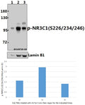 Western blot (WB) analysis of p-NR3C1(S226/234/246) pAb at 1:500 dilution
Lane1:SGC7901 whole cell lysate(40ug)
Lane2:SGC7901 treated with UV for 5 minutes then repair for 1 hour whole cell lysate(40ug)
Lane3:SGC7901 treated with UV for 5 minutes then repair for 3 hours whole cell lysate(40ug)