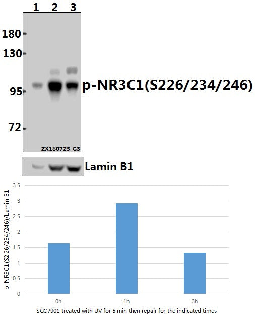 Western blot (WB) analysis of p-NR3C1(S226/234/246) pAb at 1:500 dilution
Lane1:SGC7901 whole cell lysate(40ug)
Lane2:SGC7901 treated with UV for 5 minutes then repair for 1 hour whole cell lysate(40ug)
Lane3:SGC7901 treated with UV for 5 minutes then repair for 3 hours whole cell lysate(40ug)