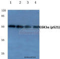 Western blot (WB) analysis of p-GSK3α (S21) polyclonal antibody at 1:500 dilution
Lane1:HEK293T cell lysate treated with UV
Lane2:Mouse liver tissue lysate
Lane3:Rat liver tissue lysate
Lane4:PC12 cell lysate treated with H2O2