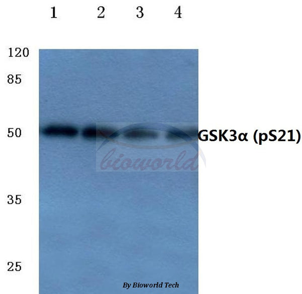 Western blot (WB) analysis of p-GSK3α (S21) polyclonal antibody at 1:500 dilution
Lane1:HEK293T cell lysate treated with UV
Lane2:Mouse liver tissue lysate
Lane3:Rat liver tissue lysate
Lane4:PC12 cell lysate treated with H2O2
