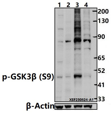 Western blot (WB) analysis of GSK3β (phospho-Ser9) pAb at 1:500 dilution
Lane1:PMVEC whole cell lysate(30ug)
Lane2:HepG2 whole cell lysate(30ug)
Lane3:HEK293T treated with Calyculin A(50 nM,30 minutes) whole cell lysate(30ug)                                                                                           Lane4:HEK293T whole cell lysate(30ug)