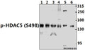 Western blot (WB) analysis of p-HDAC5 (S498) pAb at 1:1000 dilution
Lane1:The Uterus tissue lysate of Rat(40ug)
Lane2:BV2 whole cell lysate(40ug)
Lane3:C6 whole cell lysate(40ug)
Lane4:HEK293T whole cell lysate(40ug)
Lane5:Hela whole cell lysate(40ug)
Lane6:U-87MG whole cell lysate(40ug)