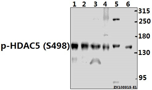 Western blot (WB) analysis of p-HDAC5 (S498) pAb at 1:1000 dilution
Lane1:The Uterus tissue lysate of Rat(40ug)
Lane2:BV2 whole cell lysate(40ug)
Lane3:C6 whole cell lysate(40ug)
Lane4:HEK293T whole cell lysate(40ug)
Lane5:Hela whole cell lysate(40ug)
Lane6:U-87MG whole cell lysate(40ug)