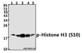 Western blot (WB) analysis of p-Histone H3 (S10) pAb at 1:1000 dilution
Lane1:HEK293T whole cell lysate(40ug)
Lane2:MCF-7 whole cell lysate(10ug)
Lane3:PC3 whole cell lysate(40ug)
Lane4:PC12 whole cell lysate(40ug)
Lane5:AML-12 whole cell lysate(40ug)