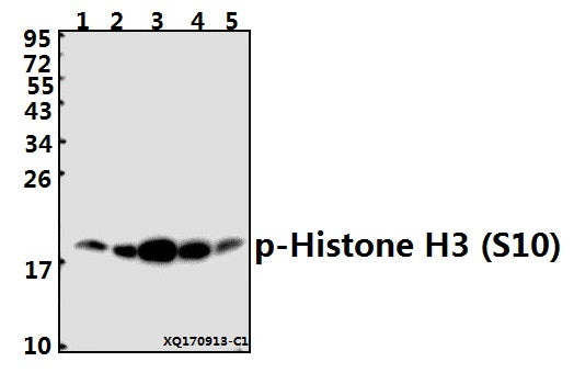 Western blot (WB) analysis of p-Histone H3 (S10) pAb at 1:1000 dilution
Lane1:HEK293T whole cell lysate(40ug)
Lane2:MCF-7 whole cell lysate(10ug)
Lane3:PC3 whole cell lysate(40ug)
Lane4:PC12 whole cell lysate(40ug)
Lane5:AML-12 whole cell lysate(40ug)