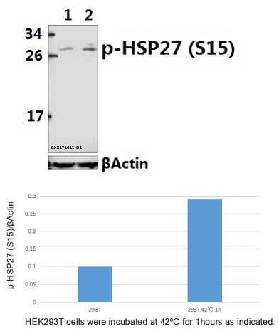 Western blot (WB) analysis of HSP27 (phospho-S15) pAb at 1:500 dilution
Lane1:HEK293T whole cell lysate
Lane2:HEK293T incubated at 42ºC for 1 hour whole cell lysate