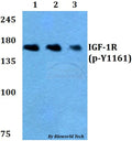 IGF-1R (Phospho-Y1161) polyclonal antibody – Figure 1 of 1