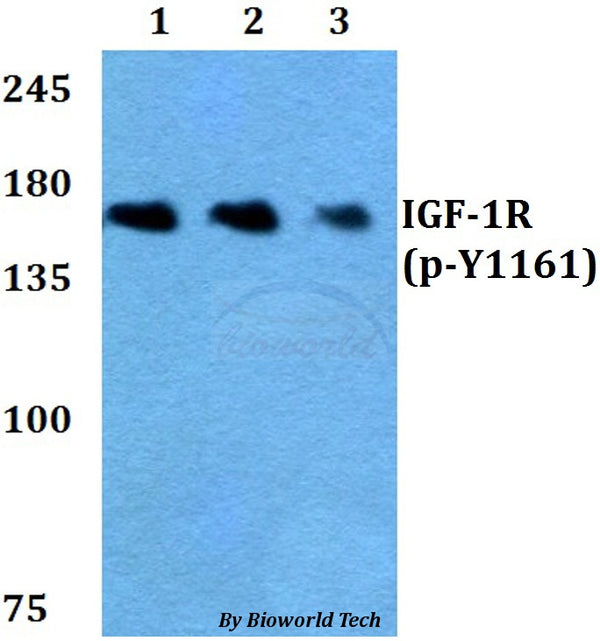IGF-1R (Phospho-Y1161) polyclonal antibody – Figure 1 of 1