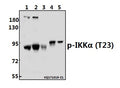 Western blot (WB) analysis of IKKα (phospho-T23) polyclonal antibody at 1:500 dilution
Lane1:K562 whole cell lysate(40ug)
Lane2:HepG2 whole cell lysate(40ug)
Lane3:HEK293T whole cell lysate(40ug)
Lane4:The Embryo tissue lysate of Rat(10ug)
Lane5:The Brain tissue lysate of Mouse(40ug)