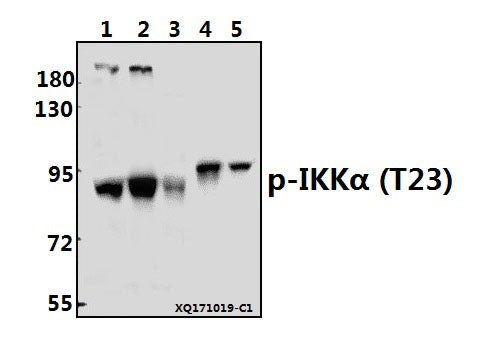 Western blot (WB) analysis of IKKα (phospho-T23) polyclonal antibody at 1:500 dilution
Lane1:K562 whole cell lysate(40ug)
Lane2:HepG2 whole cell lysate(40ug)
Lane3:HEK293T whole cell lysate(40ug)
Lane4:The Embryo tissue lysate of Rat(10ug)
Lane5:The Brain tissue lysate of Mouse(40ug)