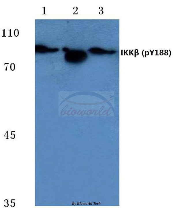 Western blot (WB) analysis of p-IKKβ (Y188) polyclonal antibody at 1:500 dilution
Lane1:Hela cell lysate treated with LPS
Lane2:Raw264.7 cell lysate treated with LPS
Lane3:PC12 cell lysate treated with LPS