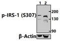 Western blot (WB) analysis of IRS-1 (Phospho-Ser307) polyclonal antibody at 1:1000 dilution
Lane1:MCF-7 treated with λ-phosphatase whole cell lysate(30ug)
Lane2:MCF-7 whole cell lysate(30ug)