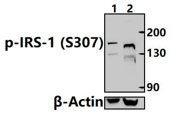 Western blot (WB) analysis of IRS-1 (Phospho-Ser307) polyclonal antibody at 1:1000 dilution
Lane1:MCF-7 treated with λ-phosphatase whole cell lysate(30ug)
Lane2:MCF-7 whole cell lysate(30ug)