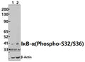 Western blot (WB) analysis of p-IkB-α (S32/S36) pAb at 1:500 dilution
Lane1:HepG2 whole cell lysate(40ug)
Lane2:MCF-7 whole cell lysate(40ug)
Lane3:A549 whole cell lysate(40ug)
Lane4:PC12 whole cell lysate(40ug)
Lane5:3T3-L1 whole cell lysate(40ug)