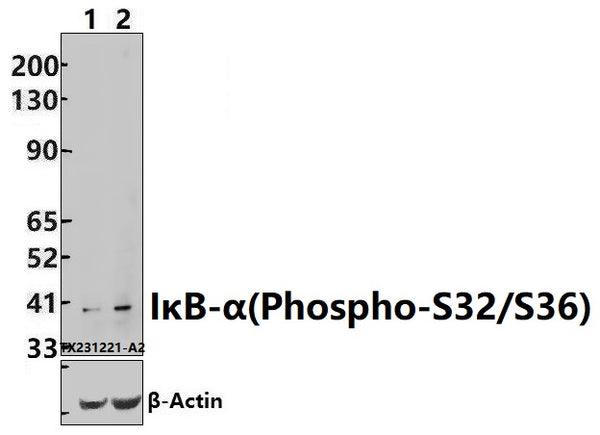 Western blot (WB) analysis of p-IkB-α (S32/S36) pAb at 1:500 dilution
Lane1:HepG2 whole cell lysate(40ug)
Lane2:MCF-7 whole cell lysate(40ug)
Lane3:A549 whole cell lysate(40ug)
Lane4:PC12 whole cell lysate(40ug)
Lane5:3T3-L1 whole cell lysate(40ug)
