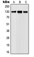 Western blot (WB) analysis of JAK1 (phospho-Y1022) polyclonal antibody at 1:500 dilution
LaneA:HEK293T whole cell lysate(40ug)                                                                                                                                                                                                      
LaneB:AD293 whole cell lysate(40ug)                                                                                         
LaneC:Hela whole cell lysate(40ug)