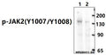 Western blot (WB) analysis of Phospho-JAK2-Y1007/1008 polyclonal antibody at 1:1000 dilution
Lane1:K562 treated with GM-CSF(100 ng/ml) at 37℃ for 15 minutes whole cell lysate(30ug)
Lane2:K562 whole cell lysate(30ug)