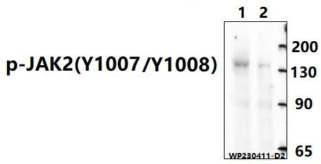 Western blot (WB) analysis of Phospho-JAK2-Y1007/1008 polyclonal antibody at 1:1000 dilution
Lane1:K562 treated with GM-CSF(100 ng/ml) at 37℃ for 15 minutes whole cell lysate(30ug)
Lane2:K562 whole cell lysate(30ug)