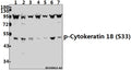 Western blot (WB) analysis of p-Cytokeratin 18 (S33) pAb at 1:500 dilution
Lane1:HCT116 whole cell lysate(40ug)
Lane2:L02 whole cell lysate(40ug)
Lane3:MCF-7 whole cell lysate(40ug)
Lane4:CT26 whole cell lysate(40ug)
Lane5:PMVEC whole cell lysate(40ug)
Lane6:A549 whole cell lysate(40ug)
Lane7:SGC7901 whole cell lysate(40ug)