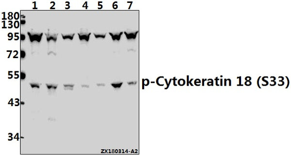 Western blot (WB) analysis of p-Cytokeratin 18 (S33) pAb at 1:500 dilution
Lane1:HCT116 whole cell lysate(40ug)
Lane2:L02 whole cell lysate(40ug)
Lane3:MCF-7 whole cell lysate(40ug)
Lane4:CT26 whole cell lysate(40ug)
Lane5:PMVEC whole cell lysate(40ug)
Lane6:A549 whole cell lysate(40ug)
Lane7:SGC7901 whole cell lysate(40ug)
