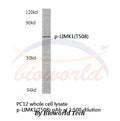 Western blot (WB) analysis of p-LIMK1 (T508) polyclonal antibody in extracts from PC12 cells.