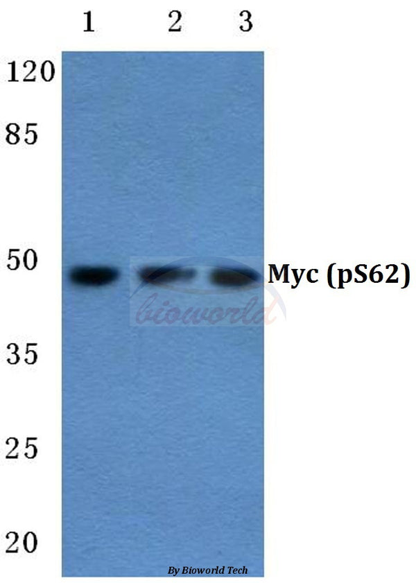 Western blot (WB) analysis of p-c-Myc (S62) polyclonal antibody at 1:500 dilution
Lane1:Hela cell lysate treated with UV
Lane2:NIH-3T3 cell lysate treated with Forskolin
Lane3:PC12 cell lysate treated with UV