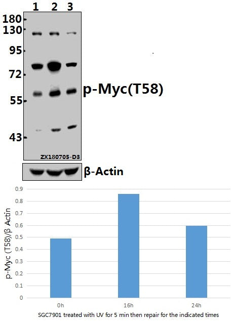 Western blot (WB) analysis of p-Myc (T58) pAb at 1:500 dilution
Lane1:SGC7901 whole cell lysate(40ug)
Lane2:SGC7901 treated with UV for 5 minutes then repair for 16 hours whole cell lysate(40ug)
Lane3:SGC7901 treated with UV for 5 minutes then repair for 24 hours whole cell lysate(40ug)