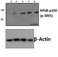 Western blot (WB) analysis of NFkB-p100 (phospho-S865) polyclonal antibody at 1:500 dilution
Lane1:NIH-3T3 whole cell lysate(40ug)
Lane2:NIH-3T3(PMA, 60ng/ml, 5min)whole cell lysate(40ug)
Lane3:NIH-3T3(PMA, 60ng/ml, 15min)whole cell lysate(40ug)
Lane4:NIH-3T3(PMA, 60ng/ml, 30min)whole cell lysate(40ug)
Lane5:NIH-3T3(EGF, 0.1ng/ml, 30min)whole cell lysate(40ug)