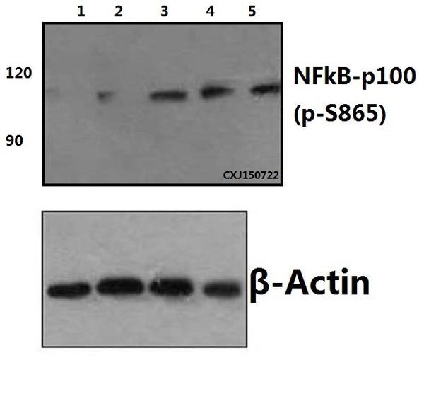 Western blot (WB) analysis of NFkB-p100 (phospho-S865) polyclonal antibody at 1:500 dilution
Lane1:NIH-3T3 whole cell lysate(40ug)
Lane2:NIH-3T3(PMA, 60ng/ml, 5min)whole cell lysate(40ug)
Lane3:NIH-3T3(PMA, 60ng/ml, 15min)whole cell lysate(40ug)
Lane4:NIH-3T3(PMA, 60ng/ml, 30min)whole cell lysate(40ug)
Lane5:NIH-3T3(EGF, 0.1ng/ml, 30min)whole cell lysate(40ug)