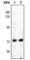 Western blot analysis of NF-kappaB p65 (pS529) expression in A2780 (A), A549 (B) whole cell lysates.