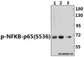 Western blot (WB) analysis of p-NFKB-p65(S536) pAb at 1:500 dilution
Lane1:HCT116 whole cell lysate(40ug)
Lane2:A2780 whole cell lysate(40ug)
Lane3:A549 whole cell lysate(40ug)