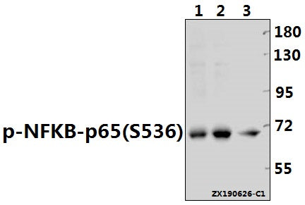 Western blot (WB) analysis of p-NFKB-p65(S536) pAb at 1:500 dilution
Lane1:HCT116 whole cell lysate(40ug)
Lane2:A2780 whole cell lysate(40ug)
Lane3:A549 whole cell lysate(40ug)
