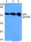Western blot (WB) analysis of p-p53 (S15) polyclonal antibody at 1:500 dilution
Lane1:HEK293T cell lysate treated with colchicine(0.2ng/ml,24h)
Lane2:Raw264.7 cell lysate treated with colchicine(0.2ng/ml,24h)
Lane3:H9C2 cell lysate treated with colchicine(0.2ng/ml,24h)