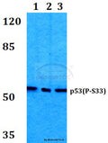 Western blot (WB) analysis of p-p53 (S33) polyclonal antibody at 1:500 dilution
Lane1:HEK293T cell lysate treated with UV(4h)
Lane2:Raw264.7 cell lysate treated with UV(4h)
Lane3:PC12 cell lysate treated with UV(4h)