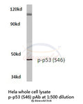 Western blot (WB) analysis of p-p53 (S46) polyclonal antibody in extracts from hela cells.