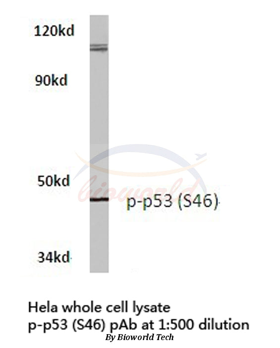 Western blot (WB) analysis of p-p53 (S46) polyclonal antibody in extracts from hela cells.