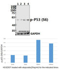 Western blot (WB) analysis of p-p53 (S6) polyclonal antibody at 1:500 dilution
Lane1:HEK293T whole cell lysate(40ug)
Lane2:HEK293T treated with Etoposide(20ng/ml) for 5 minutes whole cell lysate
Lane3:HEK293T treated with Etoposide(20ng/ml) for 30 minutes whole cell lysate
Lane4:HEK293T treated with Etoposide(20ng/ml) for 2 hours whole cell lysate