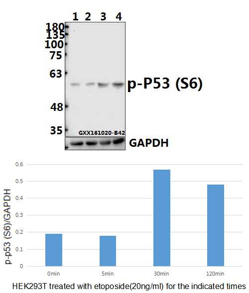Western blot (WB) analysis of p-p53 (S6) polyclonal antibody at 1:500 dilution
Lane1:HEK293T whole cell lysate(40ug)
Lane2:HEK293T treated with Etoposide(20ng/ml) for 5 minutes whole cell lysate
Lane3:HEK293T treated with Etoposide(20ng/ml) for 30 minutes whole cell lysate
Lane4:HEK293T treated with Etoposide(20ng/ml) for 2 hours whole cell lysate