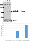 Western blot (WB) analysis of p-Nibrin (S343) pAb at 1:500 dilution
Lane1:HEK293T whole cell lysate(40ug)
Lane2:HEK293T treated with UV for 5 minutes then repair for 1 hours whole cell lysate(40ug)
Lane3:HEK293T treated with UV for 5 minutes then repair for 3 hours whole cell lysate(40ug)