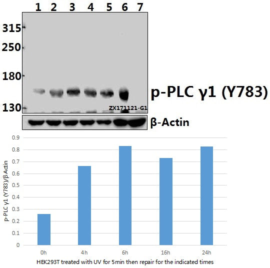 Western blot (WB) analysis of p-PLC γ1 (Y783) pAb at 1:500 dilution
Lane1:HEK293T whole cell lysate(40ug)
Lane2:HEK293T treated with UV for 5 minutes then repair for 4 hours whole cell lysate(40ug)
Lane3:HEK293T treated with UV for 5 minutes then repair for 6 hours whole cell lysate(40ug)
Lane4:HEK293T treated with UV for 5 minutes then repair for 16 hours whole cell lysate(40ug)
Lane5:HEK293T treated with UV for 5 minutes then repair for 24 hours whole cell lysate(40ug)
Lane6:C6 whole cell lysa