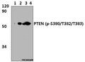 Western blot (WB) analysis of PTEN (p-S380/T382/T383) polyclonal antibody at 1:1000 dillution
Lane1:Hela whole cell lysate(30μg)
Lane2:Hela treated with PMA(60ng/ml, 30min) whole cell lysate(30μg)  Lane3:H9C2 whole cell lysate(30μg)   Lane4:H9C2 treated with PMA(60ng/ml, 30min) whole cell lysate(30μg)