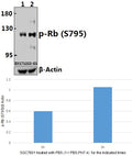 Western blot (WB) analysis of p-Rb (S795) pAb at 1:500 dilution
Lane1:SGC7901 whole cell lysate(40ug)
Lane2:SGC7901 treated with PBS (1×PBS,PH7.4) for 3 hours
 whole cell lysate(40ug)