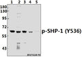 Western blot (WB) analysis of SHP-1 (phospho-Y536) polyclonal antibody at 1:500 dilution
Lane1:MCF-7 whole cell lysate(40ug)
Lane2:H1792 whole cell lysate(40ug)
Lane3:A549 whole cell lysate(40ug)
Lane4:3T3-L1 whole cell lysate(40ug)
Lane5:H9C2 whole cell lysate(40ug)